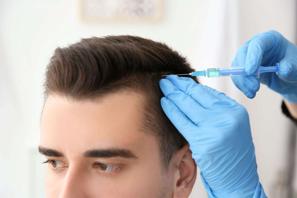 Hair Transplant